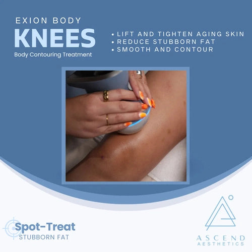 Exion Body Contouring Treatment - (Knees)