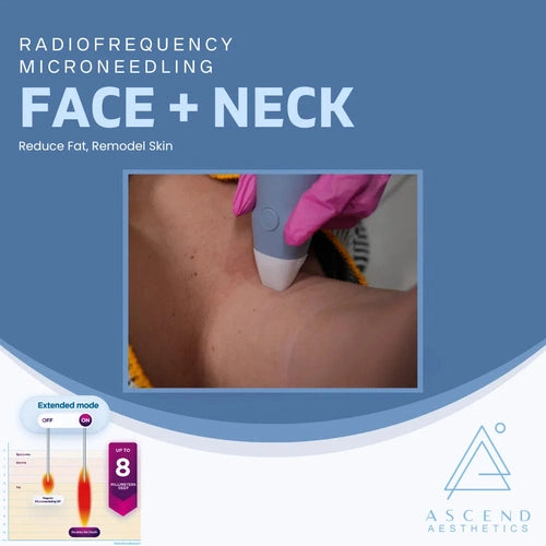 Microneedling - (Face + Neck)