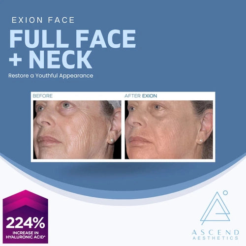 Exion Face - (Full Face + Neck)