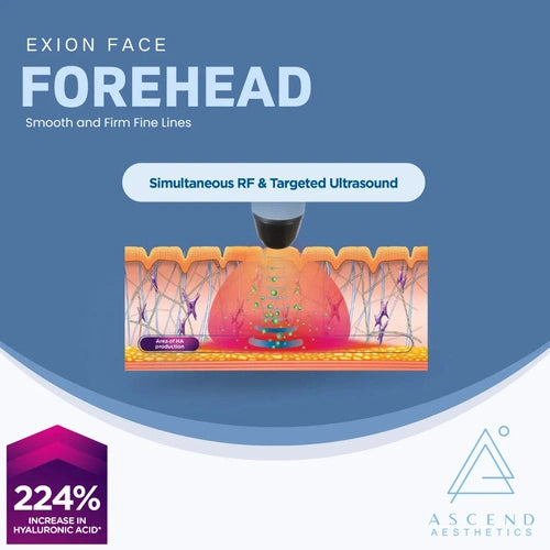 Exion Face - (Forehead Treatment)