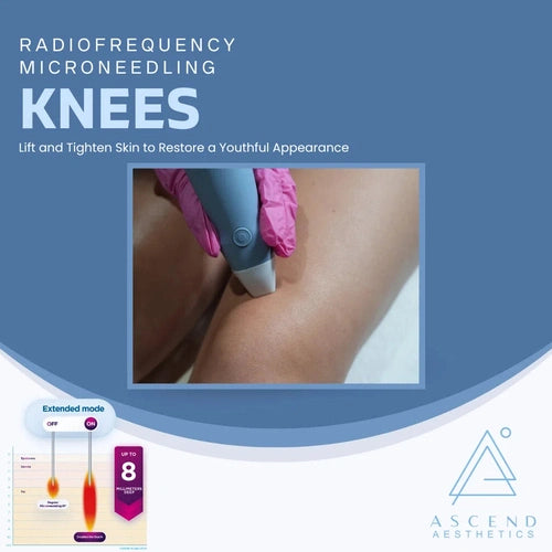 Microneedling - (Knees)